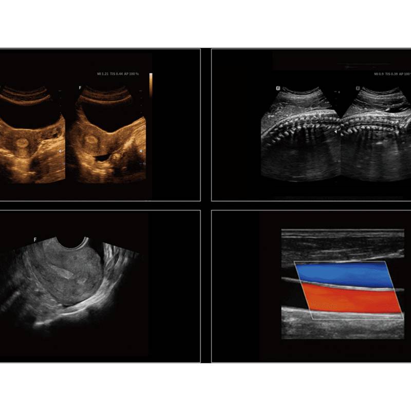 Cetus 40 ультразвукова діагностична система стаціонарна експертного класу +2 датчика Focus&Fusion, рис. 5