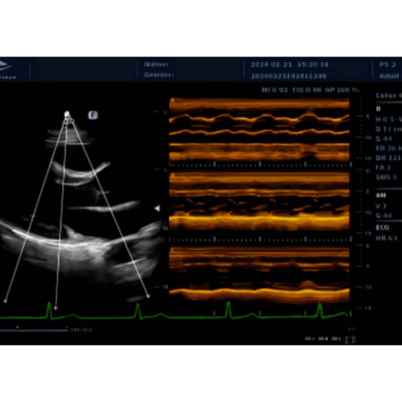 Cetus 40 ультразвукова діагностична система стаціонарна експертного класу +2 датчика Focus&Fusion, рис. 6