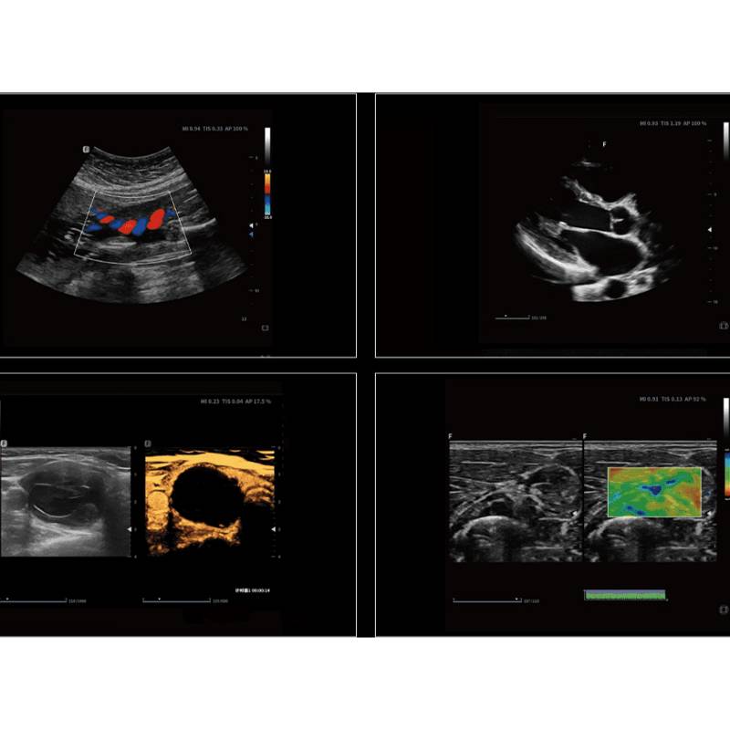Cetus 40 ультразвукова діагностична система стаціонарна експертного класу +2 датчика Focus&Fusion, рис. 4