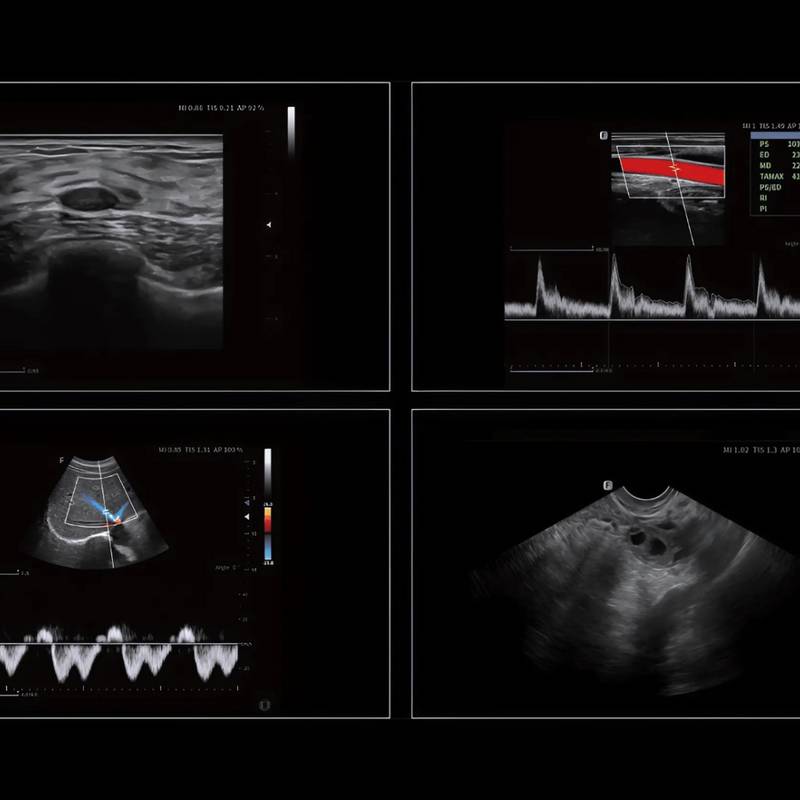 Danus 30 ультразвукова діагностична система стаціонарна високого класу +2 датчика Focus&Fusion, рис. 4
