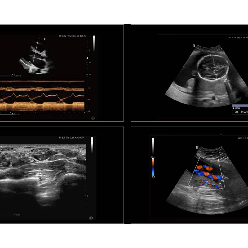 Danus 30 ультразвукова діагностична система стаціонарна високого класу +2 датчика Focus&Fusion, рис. 5