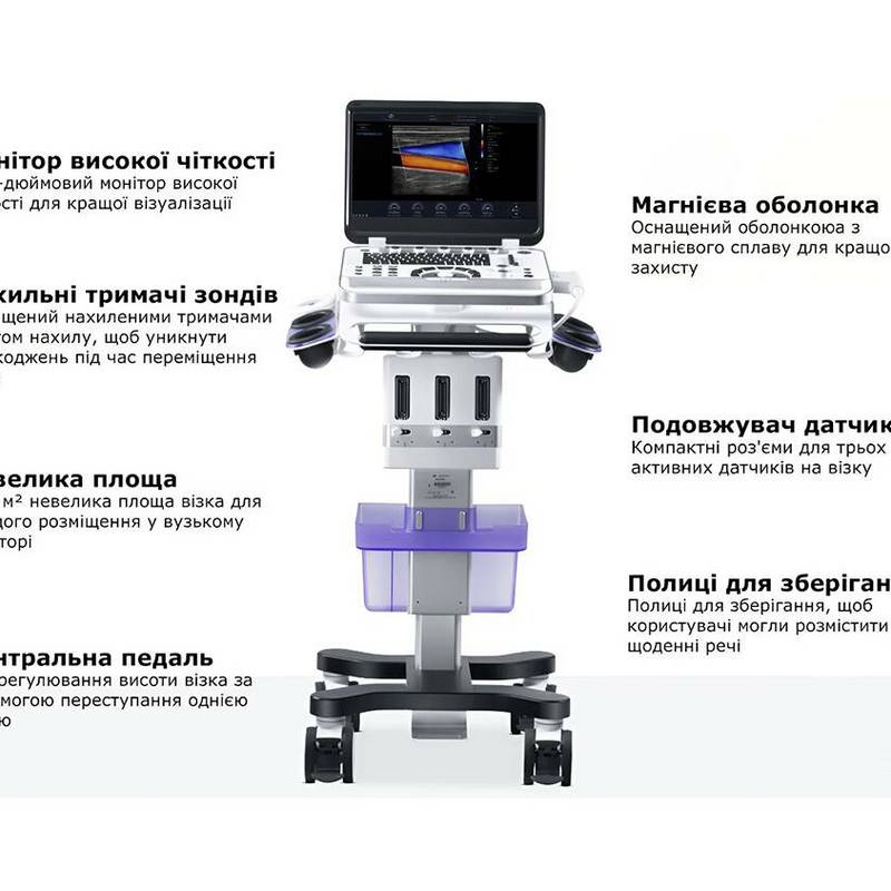 Finus 70 портативна ультразвукова діагностична система експертного класу +2 датчика Focus&Fusion, рис. 2