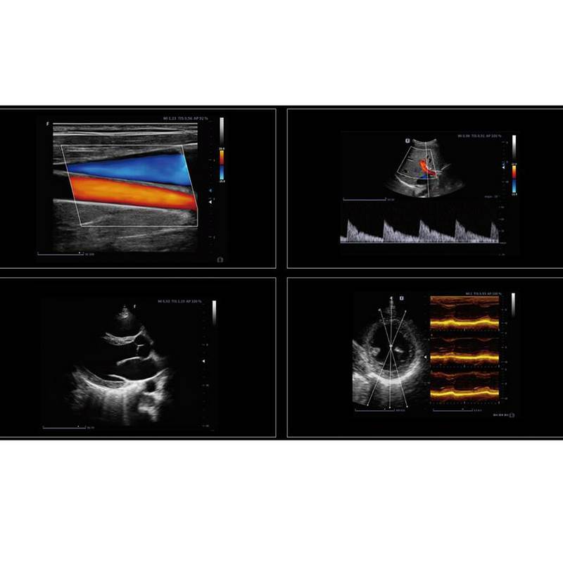 Finus 70 портативна ультразвукова діагностична система експертного класу +2 датчика Focus&Fusion, рис. 3