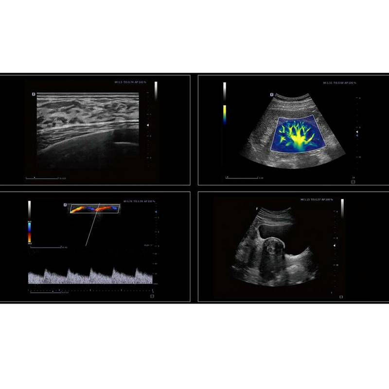 Finus 70 портативна ультразвукова діагностична система експертного класу +2 датчика Focus&Fusion, рис. 4