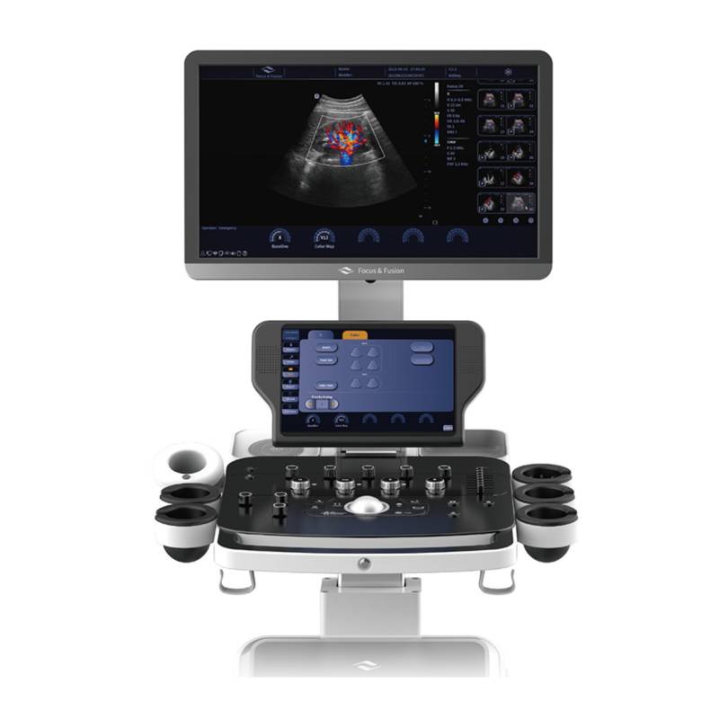 Danus 10 стаціонарна ультразвукова діагностична система високого класу +2 датчики Focus&Fusion, рис. 2