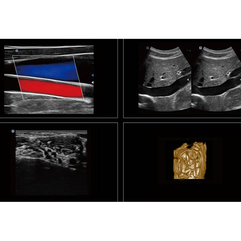 Danus 10 стаціонарна ультразвукова діагностична система високого класу +2 датчики Focus&Fusion, рис. 7