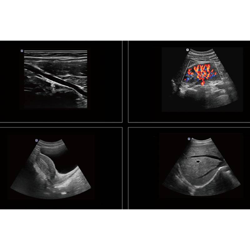 Danus 10 стаціонарна ультразвукова діагностична система високого класу +2 датчики Focus&Fusion, рис. 8