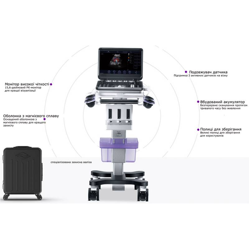Finus 50 портативна ультразвукова діагностична система високого класу +2 датчики Focus&Fusion, рис. 3