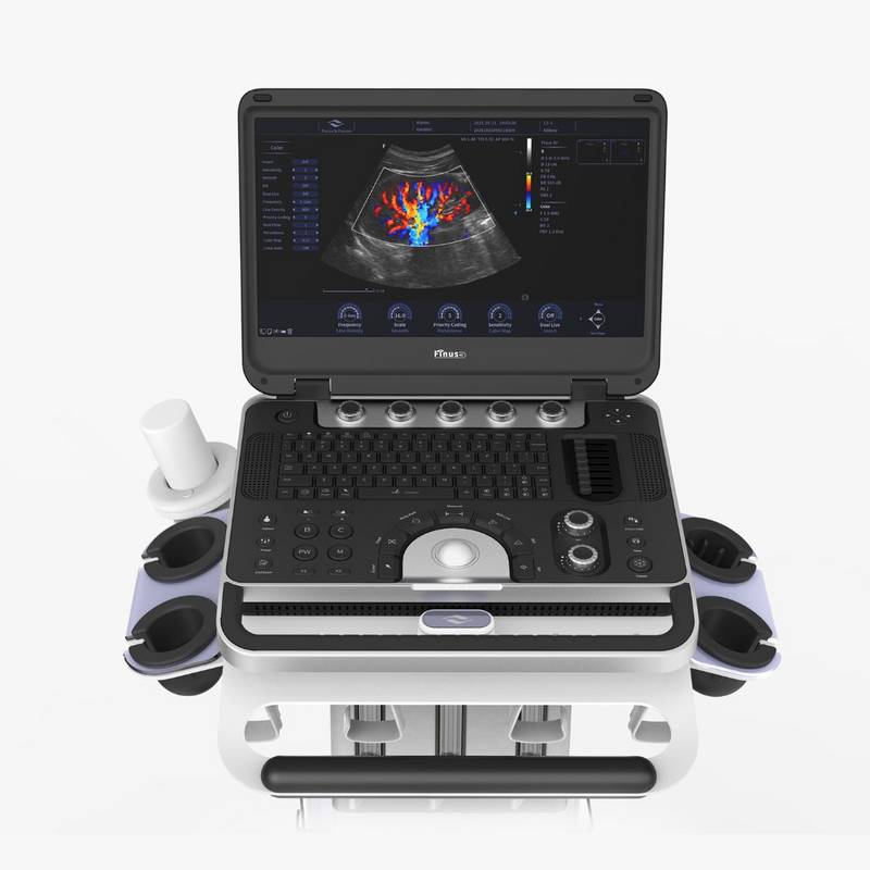 Finus 50 портативна ультразвукова діагностична система високого класу +2 датчики Focus&Fusion, рис. 1