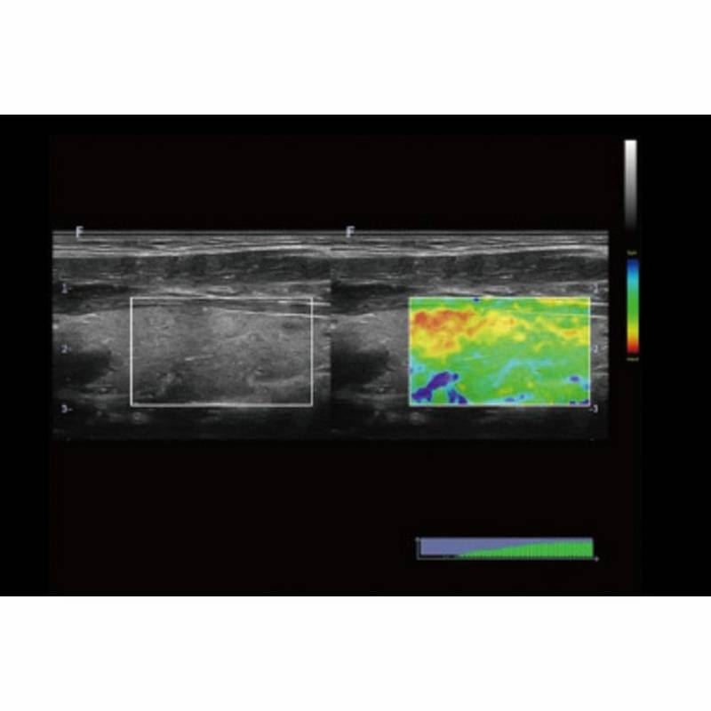 Finus 50 портативна ультразвукова діагностична система високого класу +2 датчики Focus&Fusion, рис. 5