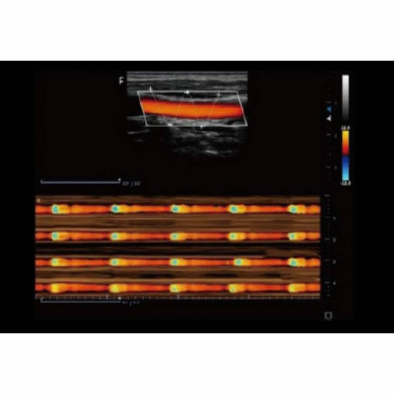 Finus 50 портативна ультразвукова діагностична система високого класу +2 датчики Focus&Fusion, рис. 6