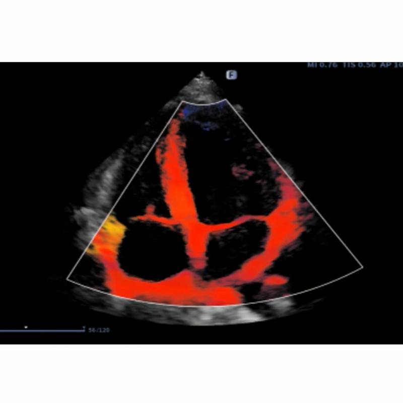 Finus 50 портативна ультразвукова діагностична система високого класу +2 датчики Focus&Fusion, рис. 7