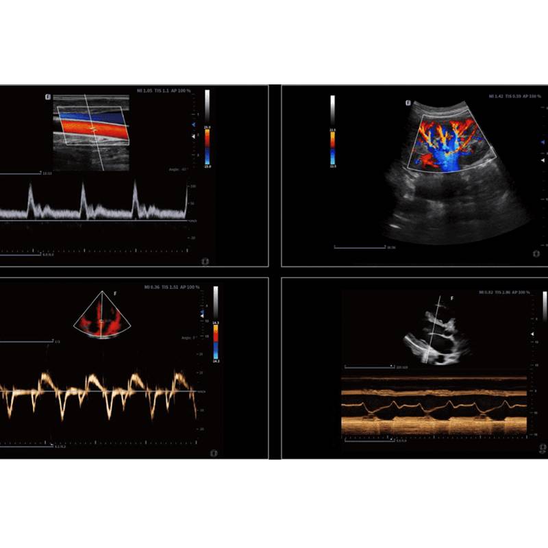 Finus 50 портативна ультразвукова діагностична система високого класу +2 датчики Focus&Fusion, рис. 4