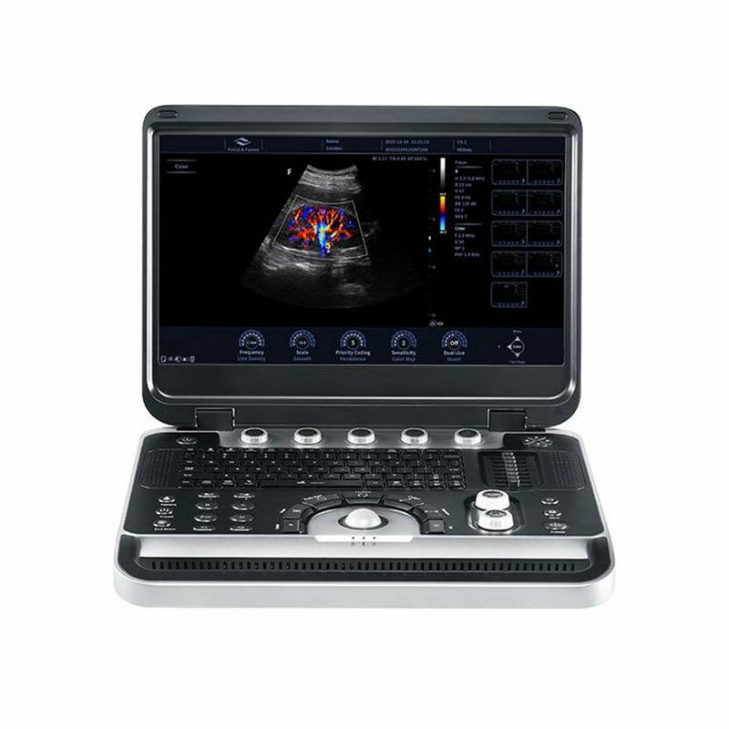 Finus 50 портативна ультразвукова діагностична система високого класу +2 датчики Focus&Fusion, рис. 0