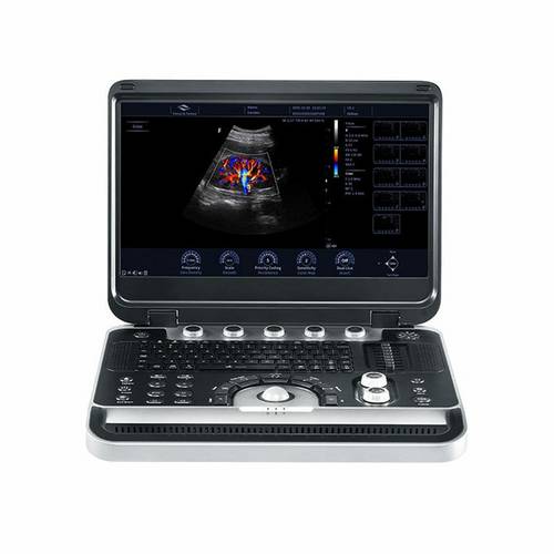Finus 50 портативна ультразвукова діагностична система високого класу +2 датчики Focus&Fusion